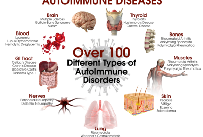 autoimmune