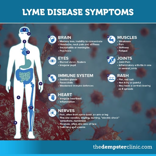 Lyme disease symptoms
